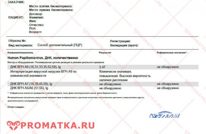 Вирусная нагрузка