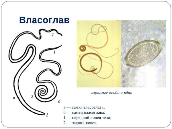 власоглав